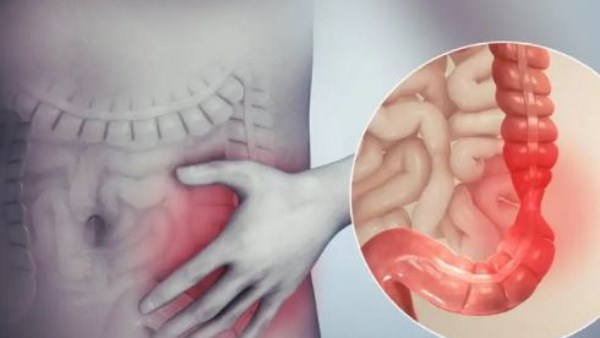 نصائح للتخلص من السموم في الجسم